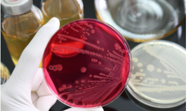 “Shocking Surge of Deadly Superbug Salmonella Sweeping Across America – Is Your Food Safe? Uncover the Disturbing Truth Now!”